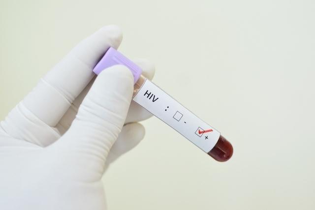 O que fazer diante da suspeita de HIV? - CLÍNICA VITTÁ